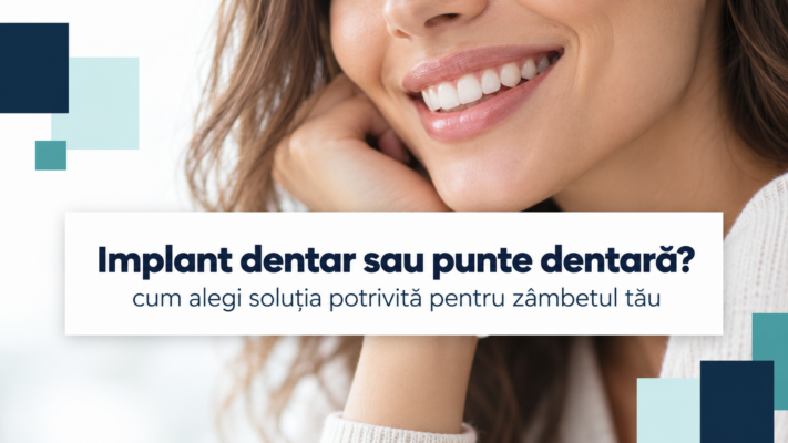 Zâmbet feminin și prezentarea opțiunilor de înlocuire a dinților lipsă prin implant dentar sau punte dentară.